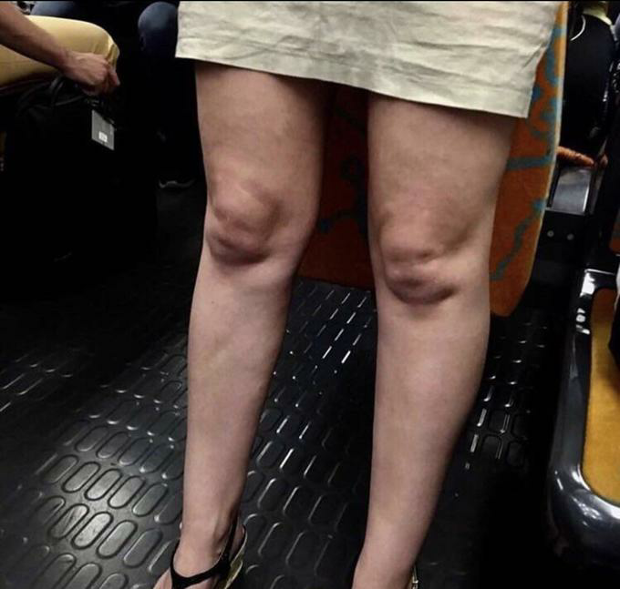 High Quality Knees look like trapped baby or Kuato Blank Meme Template