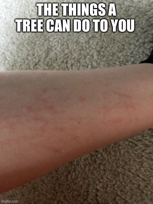 My leg is now absolutely destroyed | THE THINGS A TREE CAN DO TO YOU | made w/ Imgflip meme maker