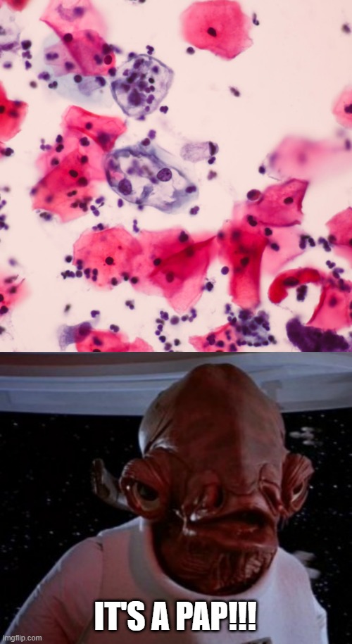 Smear | IT'S A PAP!!! | image tagged in star wars | made w/ Imgflip meme maker