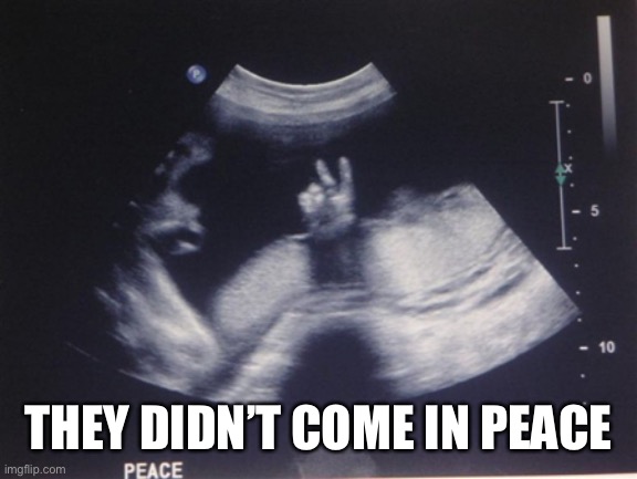 Ultrasound | THEY DIDN’T COME IN PEACE | image tagged in ultrasound | made w/ Imgflip meme maker