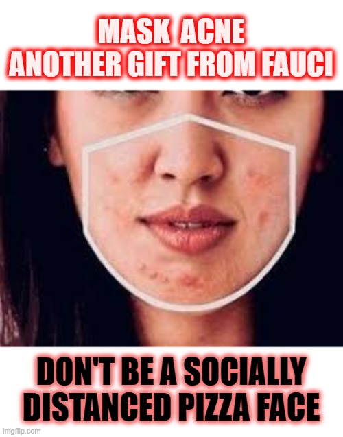 Why masks don't work: Nano virus wins over micro fiber every time. | MASK  ACNE
ANOTHER GIFT FROM FAUCI; DON'T BE A SOCIALLY DISTANCED PIZZA FACE | image tagged in acne,covid,media lies,hoaxed | made w/ Imgflip meme maker