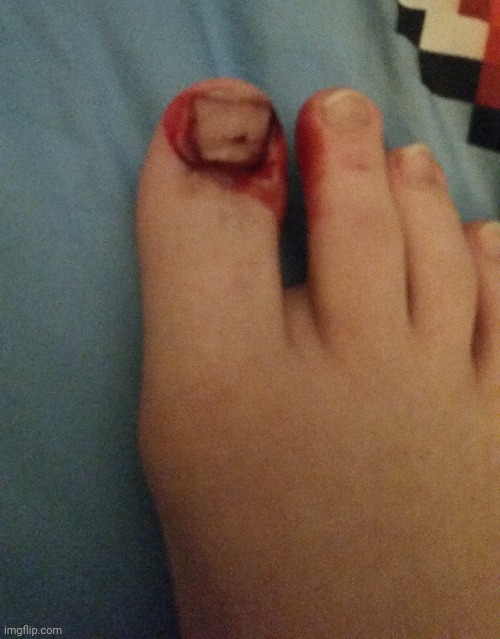 i stubbed my toe | image tagged in ouch | made w/ Imgflip meme maker