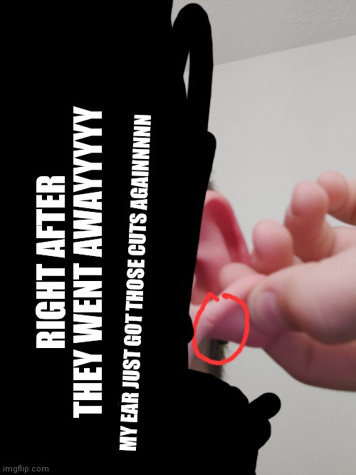RIGHT AFTER THEY WENT AWAYYYYY; MY EAR JUST GOT THOSE CUTS AGAINNNNN | made w/ Imgflip meme maker