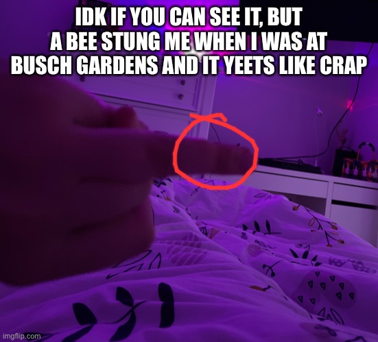 IDK IF YOU CAN SEE IT, BUT A BEE STUNG ME WHEN I WAS AT BUSCH GARDENS AND IT YEETS LIKE CRAP | image tagged in o | made w/ Imgflip meme maker