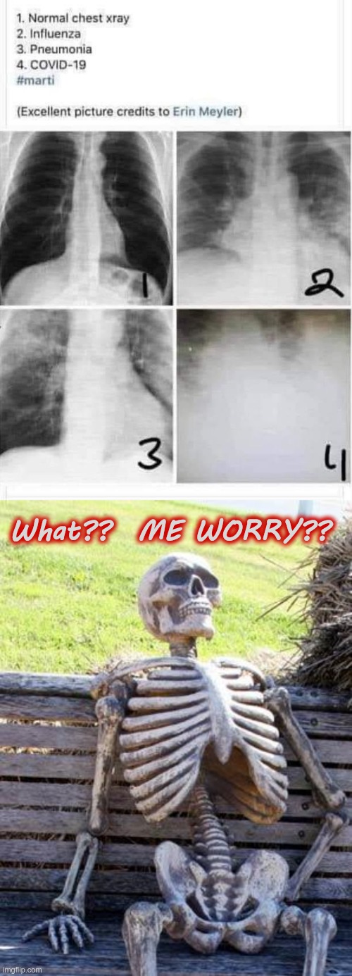 COVID ... SHMOVID ! ... | What??  ME WORRY?? | image tagged in x-rays - normal flu pneumonia covid,waiting skeleton,covid,coronavirus,dark humor,rick75230 | made w/ Imgflip meme maker