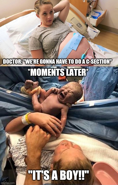 Always expect the unexpected | DOCTOR: "WE'RE GONNA HAVE TO DO A C-SECTION"; *MOMENTS LATER*; "IT'S A BOY!!" | image tagged in pregnant nst,c-section baby | made w/ Imgflip meme maker
