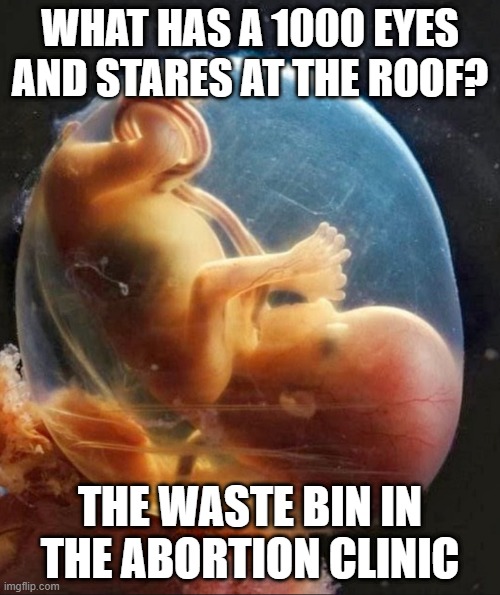 Looking | WHAT HAS A 1000 EYES AND STARES AT THE ROOF? THE WASTE BIN IN THE ABORTION CLINIC | image tagged in life begins at conception | made w/ Imgflip meme maker