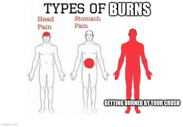 Burned by crush | BURNS; GETTING BURNED BY YOUR CRUSH | image tagged in types of pain,memes,burned,crush,ouch,rekt | made w/ Imgflip meme maker