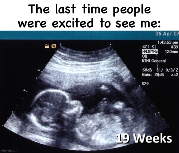 ultrasound | The last time people were excited to see me: | image tagged in ultrasound | made w/ Imgflip meme maker