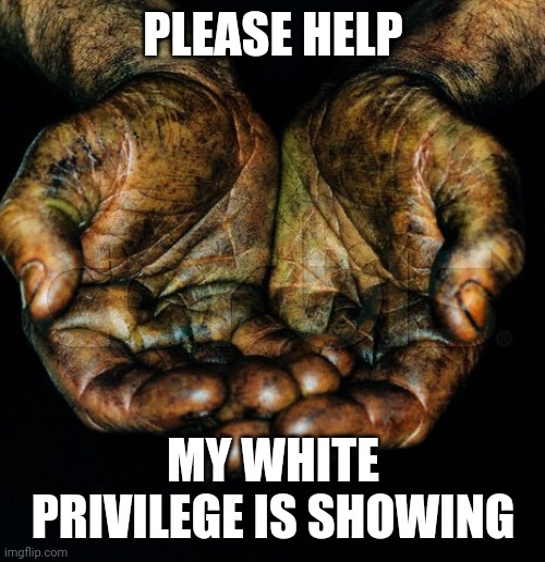 Dirty hands | PLEASE HELP MY WHITE PRIVILEGE IS SHOWING | image tagged in dirty hands | made w/ Imgflip meme maker