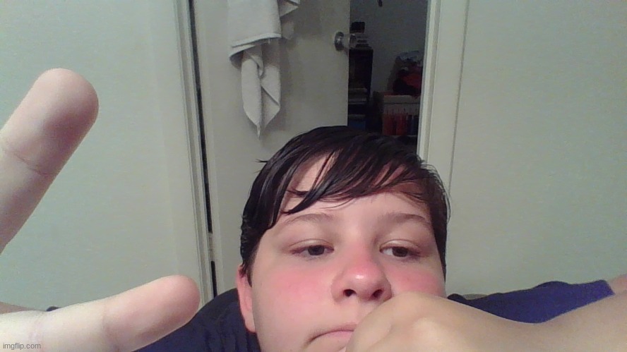 I got sunburned and now I look d i f f r e n t | made w/ Imgflip meme maker