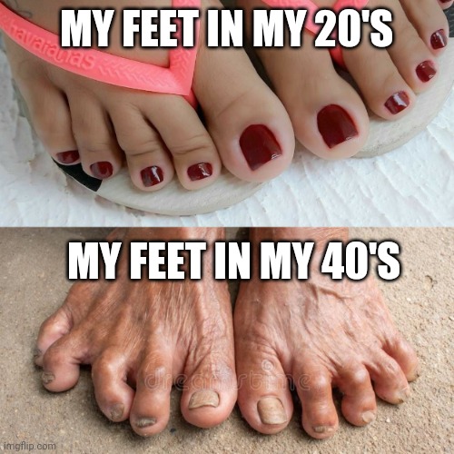 Aging | MY FEET IN MY 20'S; MY FEET IN MY 40'S | image tagged in aging,feet,women | made w/ Imgflip meme maker