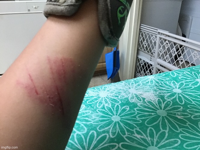 I fell on the stairs | made w/ Imgflip meme maker