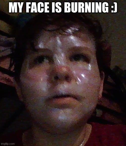 MY FACE IS BURNING :) | made w/ Imgflip meme maker