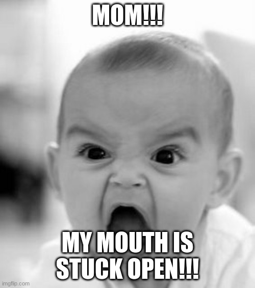 Angry Baby Meme | MOM!!! MY MOUTH IS STUCK OPEN!!! | image tagged in memes,angry baby | made w/ Imgflip meme maker