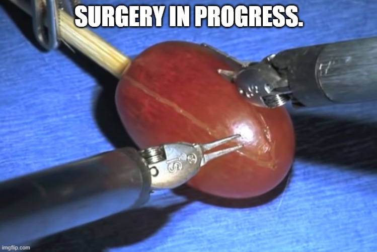 They did surgery on a grape | SURGERY IN PROGRESS. | image tagged in they did surgery on a grape | made w/ Imgflip meme maker