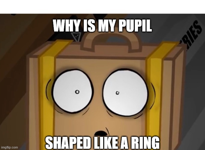 Extremely Shocked Suitcase | WHY IS MY PUPIL; SHAPED LIKE A RING | image tagged in shocked suitcase | made w/ Imgflip meme maker