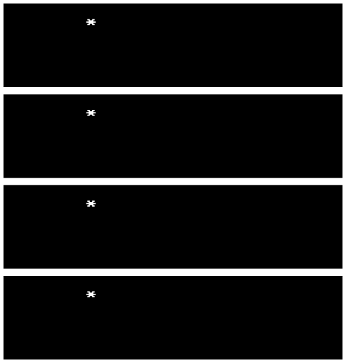 High Quality 4 undertale textboxes Blank Meme Template