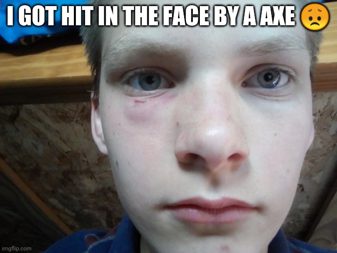 ??? | I GOT HIT IN THE FACE BY A AXE 😞 | image tagged in 1234-263 | made w/ Imgflip meme maker