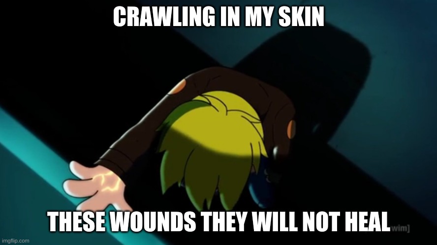 Final Space crawling in my skin | CRAWLING IN MY SKIN; THESE WOUNDS THEY WILL NOT HEAL | image tagged in crawling in my skin | made w/ Imgflip meme maker