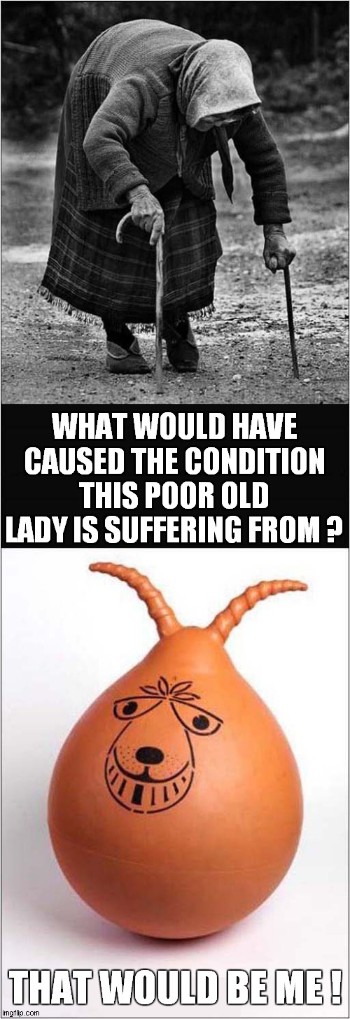 Childhood Regrets ? | WHAT WOULD HAVE CAUSED THE CONDITION THIS POOR OLD LADY IS SUFFERING FROM ? THAT WOULD BE ME ! | image tagged in regrets,old woman,space hopper,dark humour | made w/ Imgflip meme maker