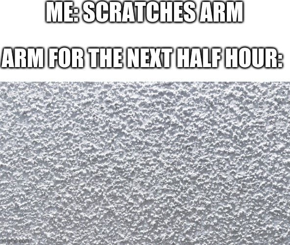 Anyone else have this happen? | ME: SCRATCHES ARM; ARM FOR THE NEXT HALF HOUR: | image tagged in funny memes | made w/ Imgflip meme maker