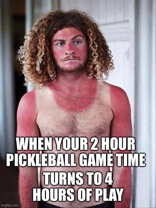 Sunburn | WHEN YOUR 2 HOUR PICKLEBALL GAME TIME; TURNS TO 4 HOURS OF PLAY | image tagged in sunburn | made w/ Imgflip meme maker