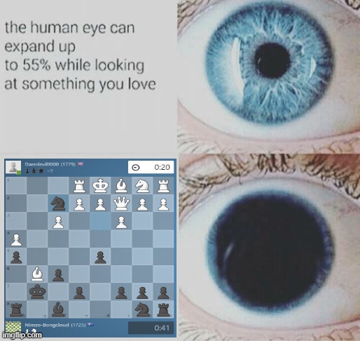 Eye pupil expand | image tagged in eye pupil expand,chess | made w/ Imgflip meme maker