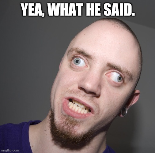 Retarted dude  | YEA, WHAT HE SAID. | image tagged in retarted dude | made w/ Imgflip meme maker