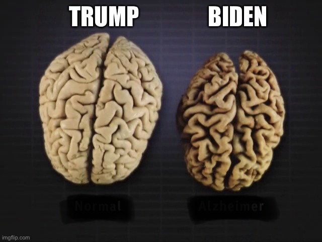 Brain | TRUMP BIDEN | image tagged in brain | made w/ Imgflip meme maker