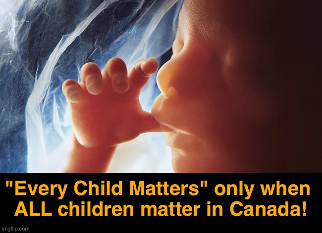Not EVERY child matters in Canada… | "Every Child Matters" only when 
ALL children matter in Canada! | image tagged in abortion,abortion is murder,canada,meanwhile in canada,truth hurts,canada day | made w/ Imgflip meme maker