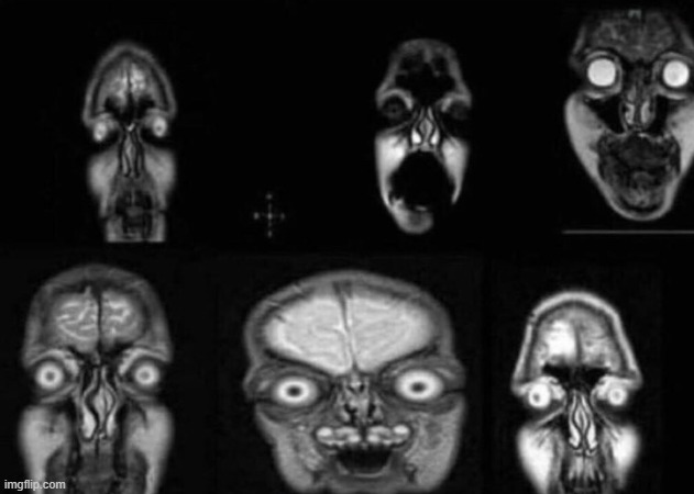 Front facing MRI scans | made w/ Imgflip meme maker