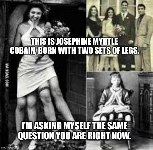 Two For One | THIS IS JOSEPHINE MYRTLE COBAIN, BORN WITH TWO SETS OF LEGS. I’M ASKING MYSELF THE SAME QUESTION YOU ARE RIGHT NOW. | image tagged in freaky | made w/ Imgflip meme maker