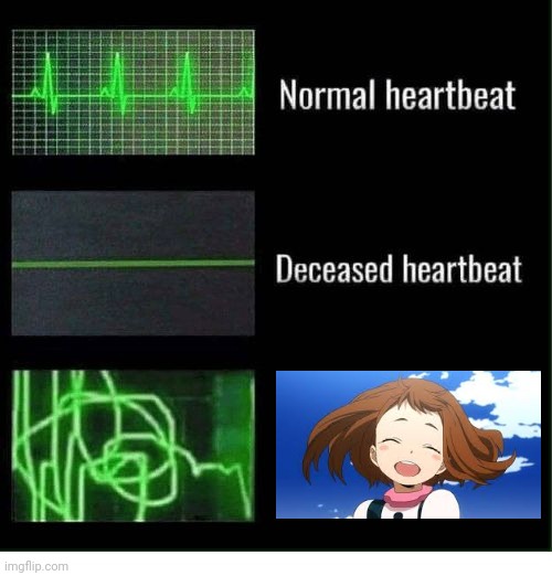 normal heartbeat deceased heartbeat | image tagged in normal heartbeat deceased heartbeat | made w/ Imgflip meme maker