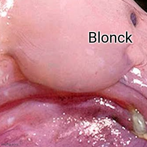 Blonck | made w/ Imgflip meme maker