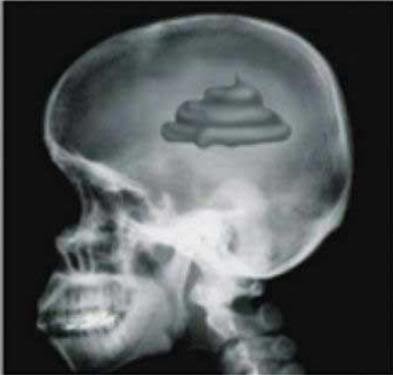 High Quality X-rays poop brain #1 Blank Meme Template