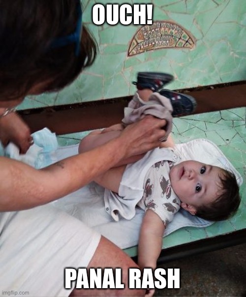 Diaper trashy | OUCH! PANAL RASH | image tagged in funny | made w/ Imgflip meme maker