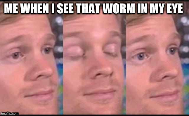 Blinking guy | ME WHEN I SEE THAT WORM IN MY EYE | image tagged in blinking guy | made w/ Imgflip meme maker