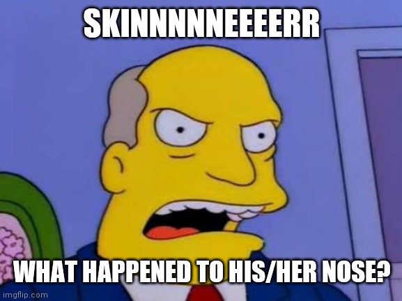 SKINNNNNEEEERR WHAT HAPPENED TO HIS/HER NOSE? | made w/ Imgflip meme maker