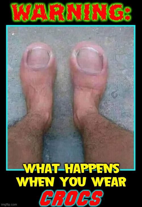 ...and now, a Public Service Announcement | Warning:; WHAT HAPPENS
WHEN YOU WEAR; crocs | image tagged in vince vance,crocs,memes,big toe,feet,hairy legs | made w/ Imgflip meme maker
