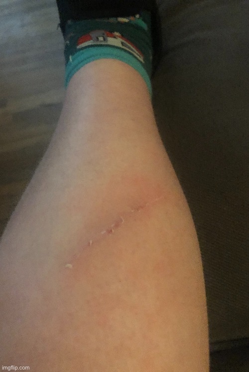 Ouch | image tagged in leg reveal | made w/ Imgflip meme maker