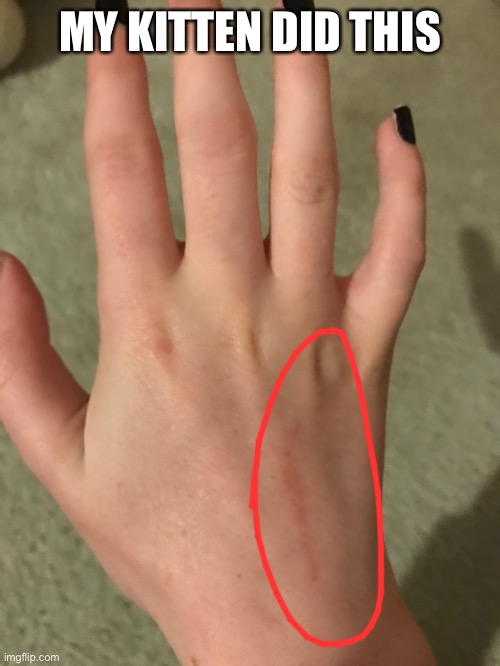 its from a few weeks ago that’s why it looks healed | MY KITTEN DID THIS | made w/ Imgflip meme maker