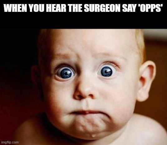 Scared Face | WHEN YOU HEAR THE SURGEON SAY 'OPPS' | image tagged in scared face | made w/ Imgflip meme maker