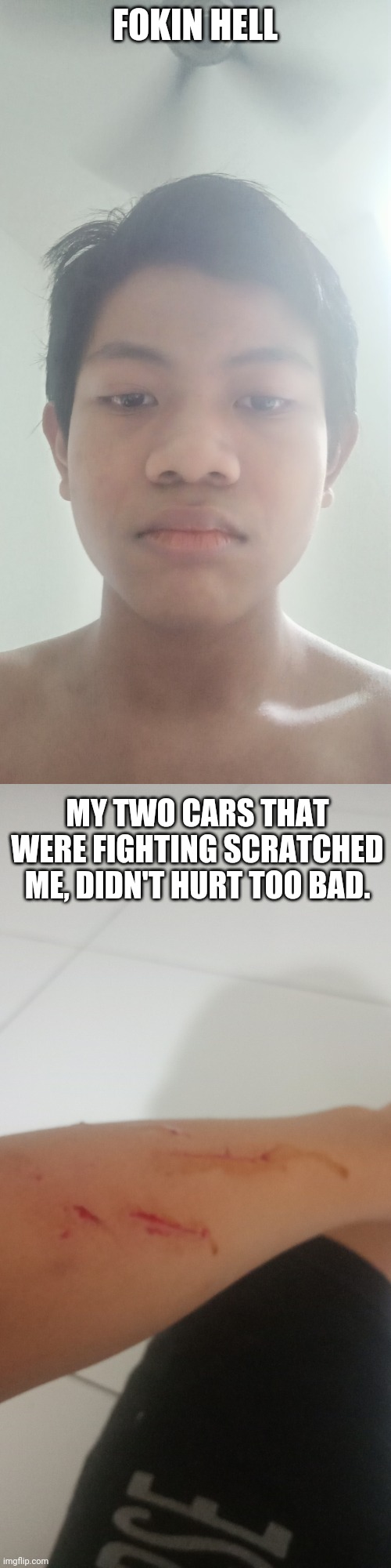 scratched me on the right leg, left arm and the back. | FOKIN HELL; MY TWO CARS THAT WERE FIGHTING SCRATCHED ME, DIDN'T HURT TOO BAD. | made w/ Imgflip meme maker