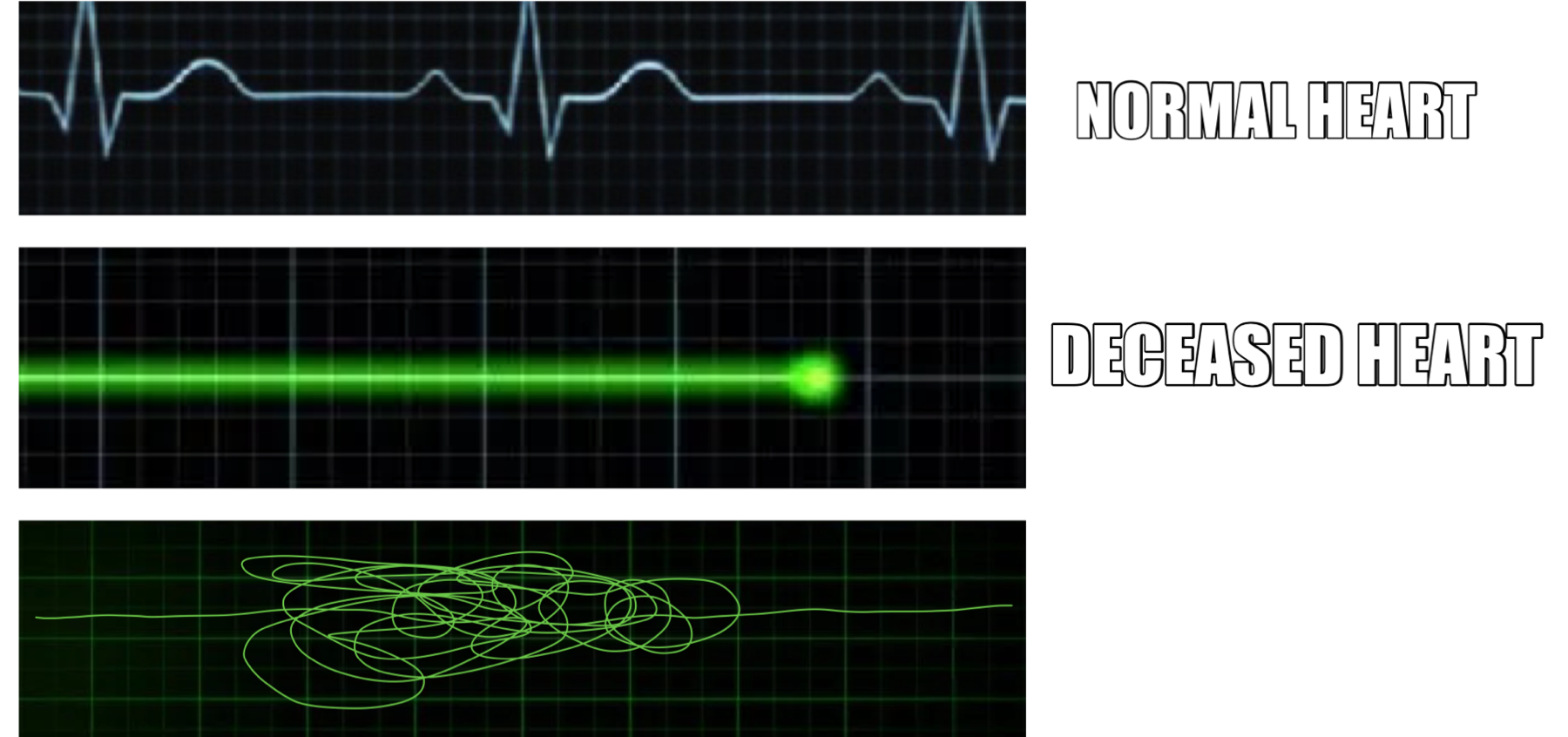 Heart rate Blank Meme Template