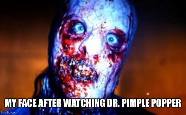 Dr. Pimple Popper | MY FACE AFTER WATCHING DR. PIMPLE POPPER | image tagged in dr pimple popper | made w/ Imgflip meme maker