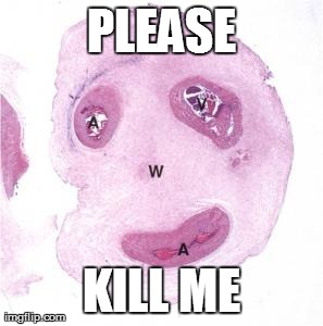 PLEASE KILL ME | image tagged in umbilical cord | made w/ Imgflip meme maker