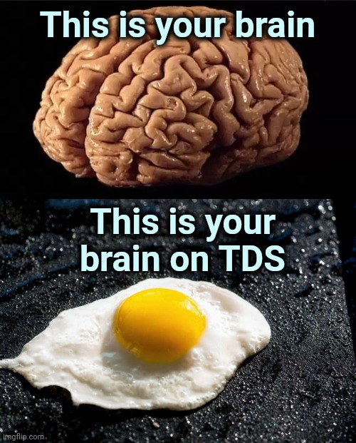 Deranged , paranoid and hateful is no way to go through life | This is your brain; This is your brain on TDS | image tagged in this is your brain,trump derangement syndrome,serious face,addiction,unhealthy,obsessive-compulsive | made w/ Imgflip meme maker