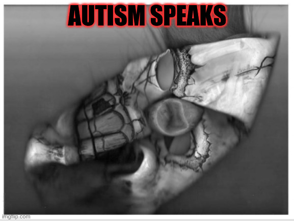 Autism Speaks |  AUTISM SPEAKS | image tagged in lolcow,autism,aspergers,clown,circus | made w/ Imgflip meme maker