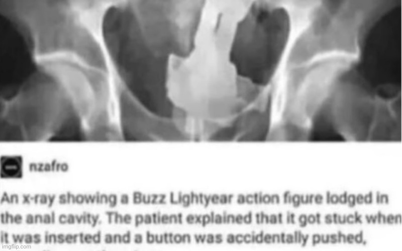 Maybe she should die ??. Do the whole gene pool a favor | made w/ Imgflip meme maker